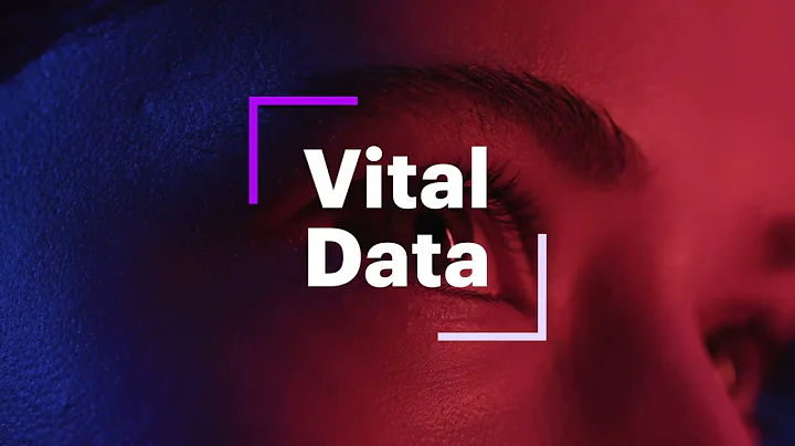 Teradata migration to Big Query