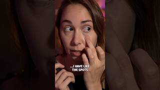 I Have A Rare Skin Condition