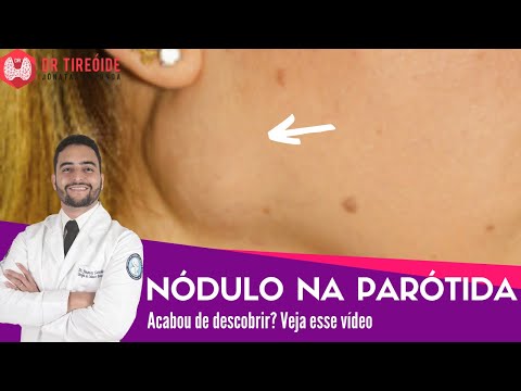 Vídeo: Cisto De Parótida