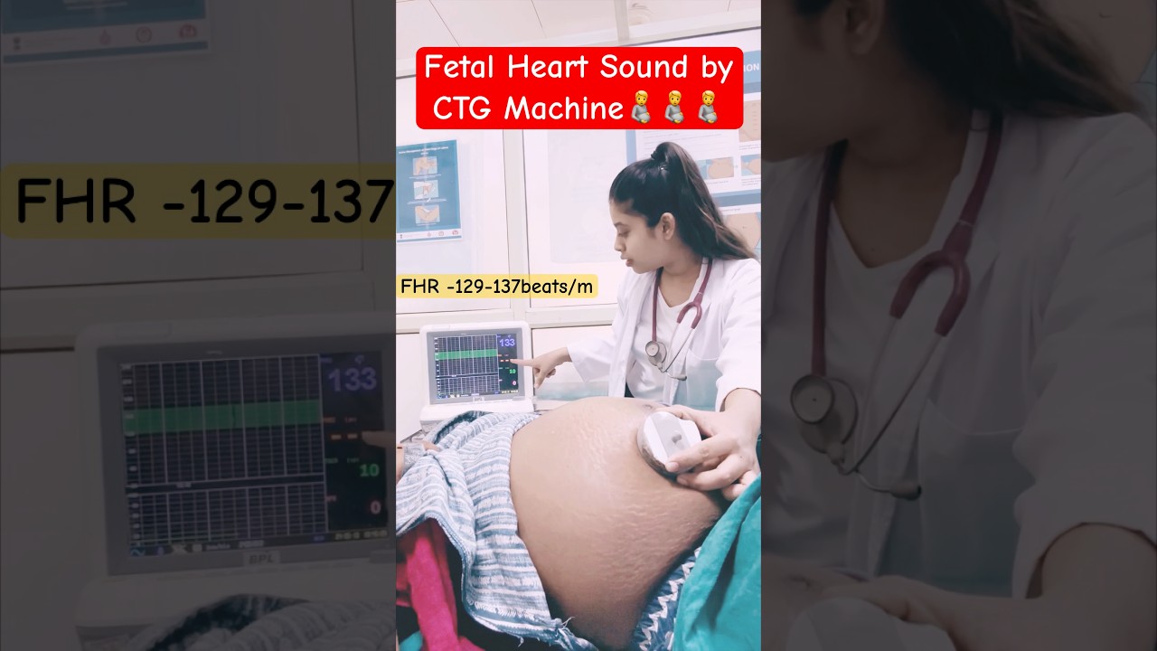 fetal heart sound by CTG machine