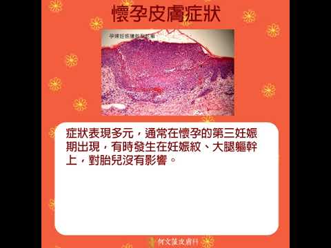 認識懷孕的皮膚變化 (生理性 vs 病態性)