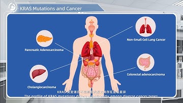 KRAS Mutations and Cancer