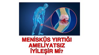 MENİSKÜS YIRTIĞI AMELİYATSIZ İYİLEŞİR Mİ?