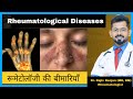     common rheumatological diseases