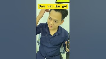 1. Tóc mọc dày đẹp với dầu gội kích mọc tóc DHT hỗ trợ cải thiện rụng tóc, thưa hói