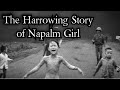The Harrowing Story Of Napalm Girl