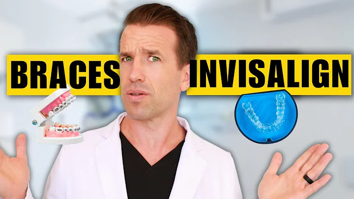 Braces vs Invisalign🤔- Which is faster and cheaper?!