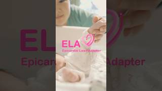 The Epicardial Lead Adapter (ELA) System