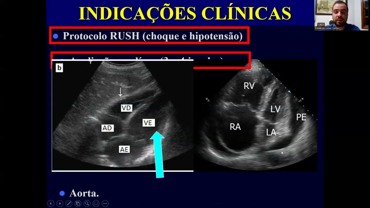 Ultrassonografia à beira leito na urgência, emergência e na UTI.