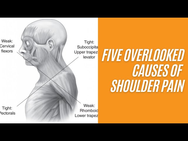 Shoulder Pain: Common Causes and How To Treat It - Philadelphia