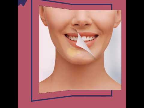 عيادة أسنان بالكويت أفضل عيادة تجميل أسنان بالكويت