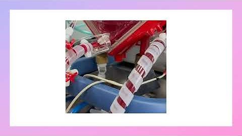 Extracorporeal memberane oxygenation (ECMO) complication (part 2)