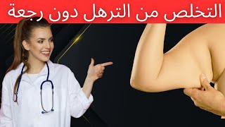 الترهّل | أفضل طريقة لإبقاء الجلد مشدود دون ترهلات