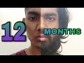1 YEAR Hair and Beard Growth Time Lapse