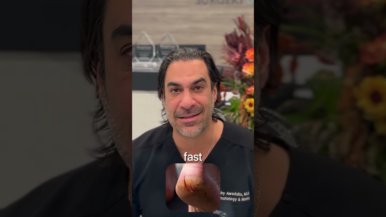 Don't ignore cracked heels