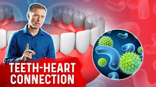 Could Heart Dysfunction Come From an Infected Tooth?