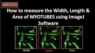 How to measure the Width Length and Area of Myotubes using ImageJ Software