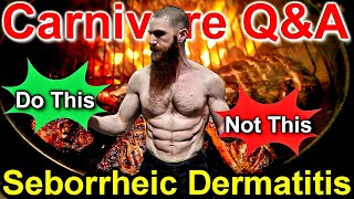 Carnivore Q&A: SEBORRHEIC DERMATITIS & THE CARNIVORE DIET: Trying Carnivore as an ELIMINATION DIET!