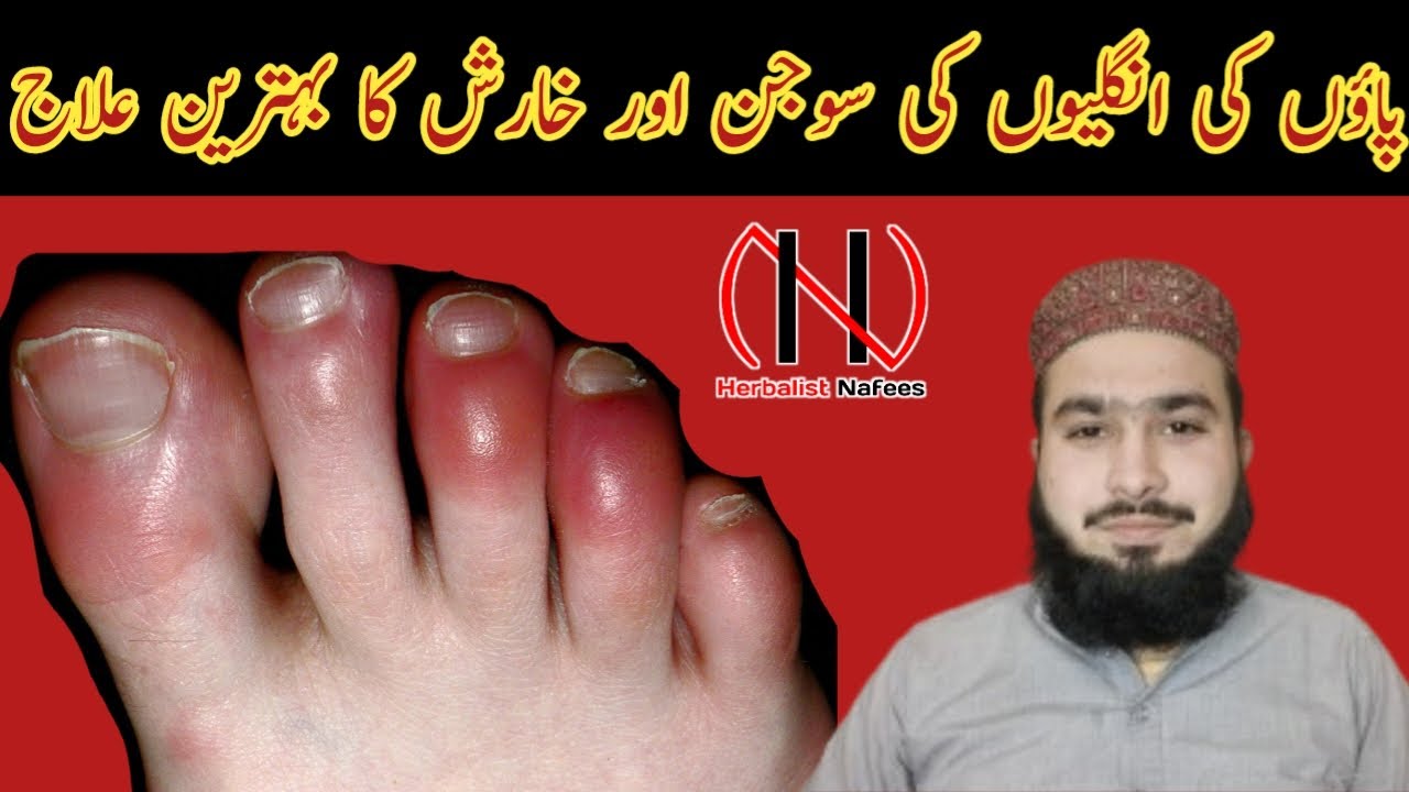 Sardiyo me pair ki ungli sujan ka gharelu ilaj Herbalist Nafees YouTube