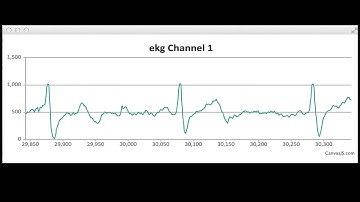DIY Arduino + Javascript EKG (electrocardiogram)