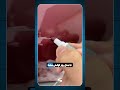 فقط یه خراش ساده است