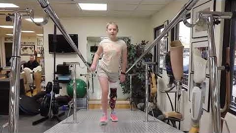 Delaney at A Step Ahead Prosthetics