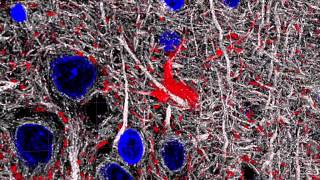 Microtubule cytoskeletons of cortical axons and dendrites