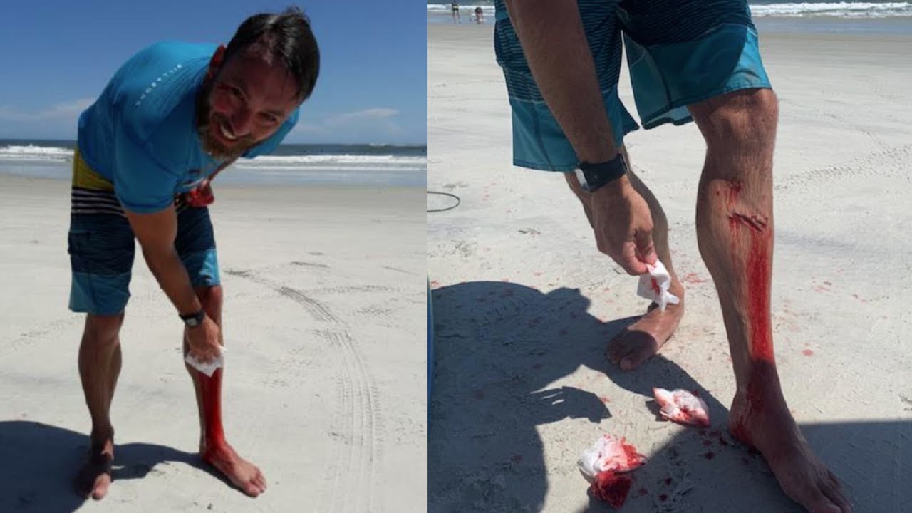 newspaper mockup Shark bites surfer in Volusia County