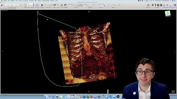 How-To: Creating a 3D Reconstruction of Your Patient