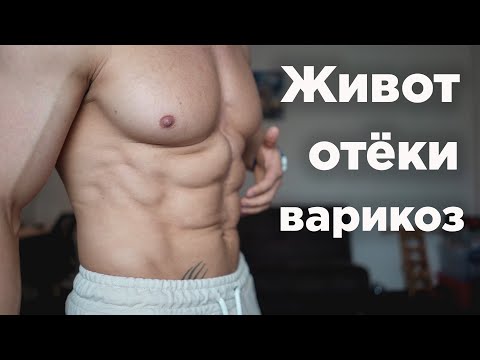 Надутый ЖИВОТ! Боли в пояснице! Отёки! Варикоз! Спазм ДИАФРАГМЫ