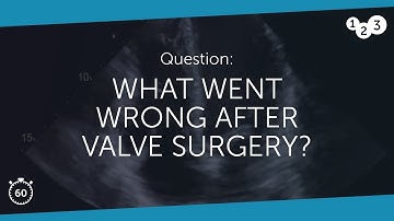 60 Seconds of Echo Teaching Question: What went wrong?