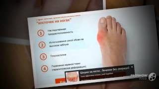 valgus pro отзывы - valgus pro применение