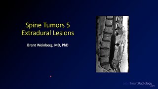 Spine tumors 5 – Extradural Lesions