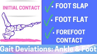 Gait Deviations: Foot & Ankle I Initial Contact of the Gait Cycle