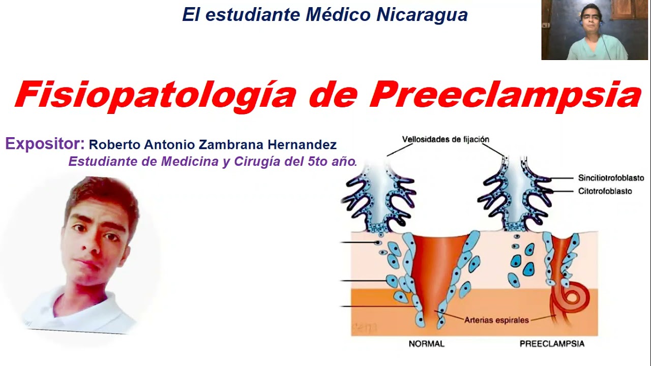 Fisiopatologia De Preeclampsia Youtube