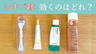 ニキビ跡の治し方。効果があった化粧品を比較してみた