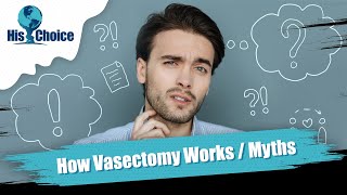 His Choice Vasectomy | How does a vasectomy procedure work?