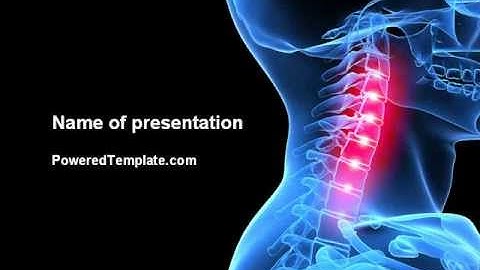 Pain Of The Neck PowerPoint Template by PoweredTemplate.com