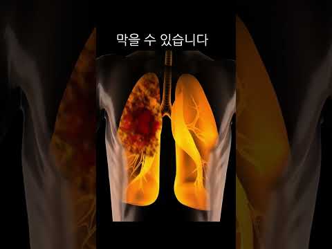 압사 대처법 (인파속에 갇혔다면 이 방법을 쓰세요)