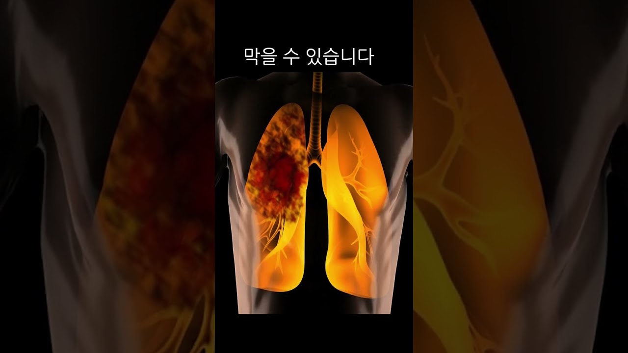 압사 대처법 (인파속에 갇혔다면 이 방법을 쓰세요)