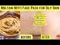 How To Reduce Open Pores And Blackheads Multani Mitti Face Pack For Glowing Skin Pimples Dark Spots