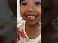 First baby tooth removed on July 10, 2025🤓 #fypviral #shortvideo #babytooth #cute #cutebaby