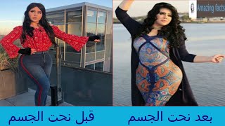 مروة راتب قبل وبعد التجميل ، مروة راتب بعد التجميل ، Marwa Rateb before and after plastic surgery