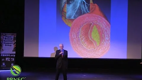 Treating the Cause to Prevent and Reverse Heart Disease with Dr. Caldwell Esselstyn