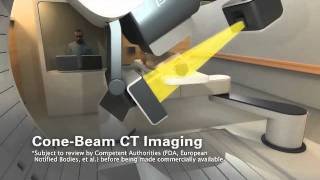 ProteusONE IBA Proton Therapy
