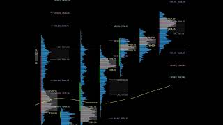 Finding High-Probability Trade Locations with Volume Profile (Live Chart Walkthrough)