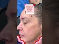 Conquer Crows Feet!