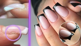 Rattrapage forme &amp; ongle crochu en Dual form- Popits