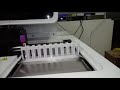 XN 2000 (SYSMEX)Processing a CBC (Complete blood Count) Test Sample