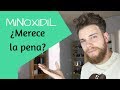 MINOXIDIL: ¿Es realmente válido para tratar la CAÍDA DEL PELO?